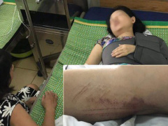 Ảnh bìa bài viết 639531