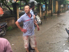 Ảnh bìa bài viết 639649