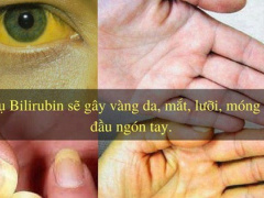 Ảnh bìa bài viết 641345