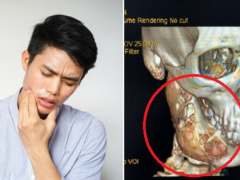 Ảnh bìa bài viết 641877