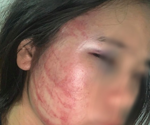Xót xa thay thân phận đàn bà: Mang bầu 7 tháng còn bị chồng ăn nhậu về đánh đập dã man