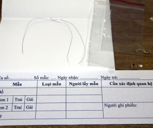 Ba lần thất vọng của anh Tây ở phòng xét nghiệm ADN Hà Nội