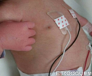 Bé trai 15 ngày tuổi sốt kéo dài, chân tay sưng đỏ vì mắc căn bệnh dễ nhầm lẫn với cảm thông thường