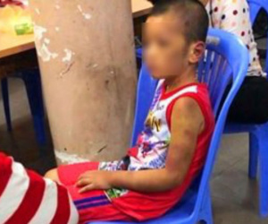 Vụ người phụ nữ và bạn tình đồng tính bạo hành con: Bé trai bị tra tấn hằng ngày bằng tay chân, cán chổi