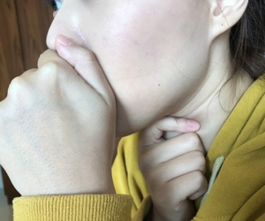 Cô gái 21 tuổi chỉ sống được 5 ngày sau khi phát hiện bị ung thư: Cảnh báo dấu hiệu ai cũng phải chú ý
