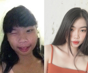 Khoe ảnh 'dậy thì thành công', nữ sinh 2k1 bị dân mạng nghi ngờ phẫu thuật thẩm mỹ, và lời đáp trả 'gai góc' của cô nàng