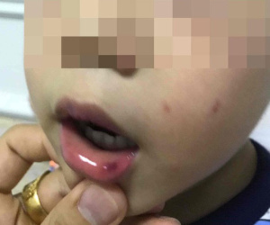 Lá thư xin lỗi gửi lúc đêm muộn của cô giáo ở Hà Nội tát bé hơn 2 tuổi sấp mặt, tụ máu môi