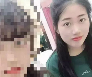 Nhiệt miệng kéo dài, cô gái 24 tuổi không ngờ bị ung thư máu