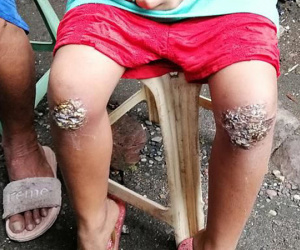 Mẹ bắt con 8 tuổi quỳ trên than nóng vì quên mang ba lô về nhà