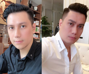 Cuối cùng Việt Anh cũng chịu lên tiếng giải thích lý do thẩm mỹ khiến gương mặt khác hẳn, phủ nhận chuyện hạ gò má, mở hốc mắt