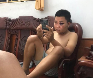 Chàng trai 'số nhọ': Làm tiệc chia tay cuộc sống độc thân để lấy vợ, ai ngờ nhậu say đến mức 'ngã sấp mặt' thâm tím mắt như bị ai đấm