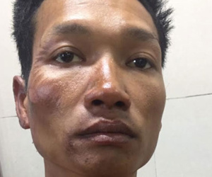 Đốt nhà, dìm vợ chết trong bể nước do cuồng ghen