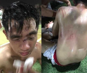 Hà Nội: Tranh chấp khi đá bóng, 15 cầu thủ lao vào đánh đối phương nhập viện