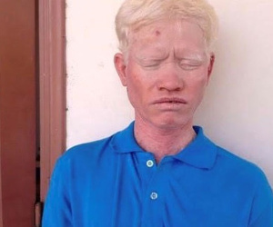 Đánh em trai vỡ sọ não tử vong, lãnh án 14 năm tù giam