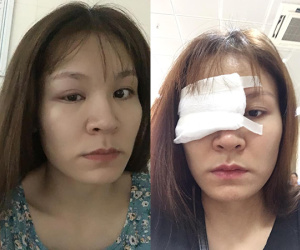 Cô gái tâm sự chuyện lỡ tay làm lọ keo 502 đổ vào mặt, cộng đồng mạng bình luận: 'Chắc là có âm mưu gì đó...'