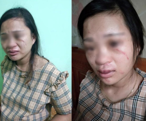 Mua đôi giày 135 ngàn, thai phụ 8 tháng bị mẹ chồng nói theo trai rồi xúi con đánh chảy máu mắt, bầm tím người