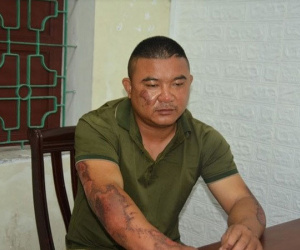 Ảnh minh họa