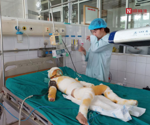 Vụ cô giáo đốt cồn dạy phòng chống cháy nổ: Nghẹn ngào lời kể của người mẹ trẻ
