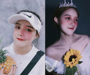 Cô gái có vết chàm lớn trên mặt trở thành mẫu lookbook nổi tiếng: Điều quan trọng là phải tự tin vào chính mình