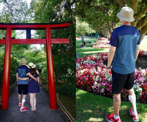 Việt kiều Canada sau 7 tháng bị cắt gân chân và tạt axit giờ ra sao?