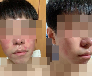 Anh chàng dị ứng tôm 'cố sống cố chết' ăn cơm hộp do bạn gái làm và cái kết