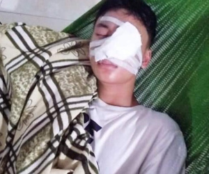 Nam Định: Nam sinh lớp 10 bị nát mặt vì chó lạ tấn công