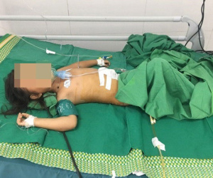 Bé gái bị máy cắt cỏ chém thủng bụng, gia đình dùng kim chỉ thường khâu sống không gây tê