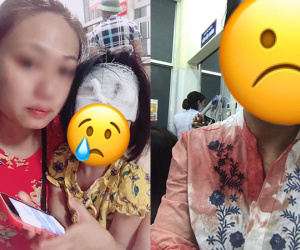 Chồng cầm chảo đánh vợ lúc cãi nhau, con gái hơn 3 tuổi bị vạ lây phải khâu 5 mũi khiến dân mạng xót xa