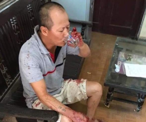 Đối tượng truy sát cả gia đình em trai khiến 5 người thương vong bình thản khi bị bắt: 'Mọi người ở lại mạnh khỏe tôi đi đây, dù sao cũng chết'