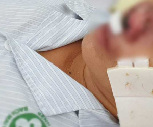 Sự thật sau tin đồn Quảng Bình xuất hiện 'vi khuẩn ăn thịt người'