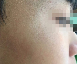 TP.HCM: Tài xế xe ôm công nghệ nghi hành hung học sinh lớp 9 dẫn đến chấn thương vì đứng sai điểm đón