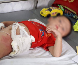 Thông tin sốc về người bác ruột ném cháu vào đống lửa vì tranh ăn dưa