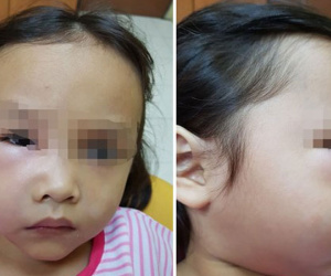 Bé gái suýt chết vì sâu răng, nha sĩ trách cha mẹ hại con vì thói quen tai hại
