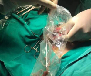 Từ vụ lấy búi giun trong bụng bé 11 tuổi, cha mẹ làm ngay việc này kẻo sau hối tiếc