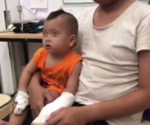 Tai nạn kinh hoàng: Người nhà thử xe máy mới mua, bé trai 1 tuổi bị đứt lìa 4 ngón tay