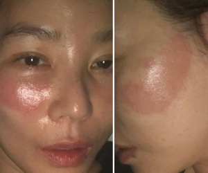 Phát hoảng 'mẹ Kim Tan' bị hằn 2 vệt rát đỏ to trên mặt vì... đắp mặt nạ quá lâu, sốc đến mức tự gọi bản thân là 'quái vật'