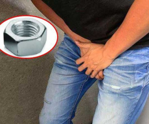 Người đàn ông cấy gần chục chiếc đinh vít vào của quý để tăng khoái cảm và cái kết không lường trước