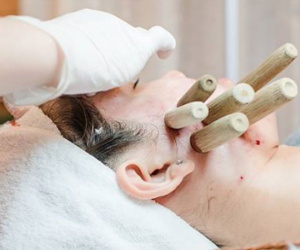 Hút mụn bằng ống tre đang rầm rộ tại các spa: Chuyên gia cảnh báo những ai muốn làm cần chú ý điều này