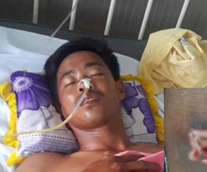 Đình chỉ công tác trưởng công an xã nghi 'cướp cò' súng làm bị thương thanh niên bắt chuột