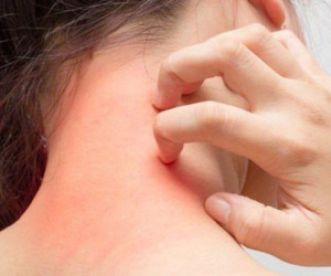 Ba mẹ con bị ngứa râm ran khắp người, đi khám phát hiện cùng mắc chung một loại bệnh