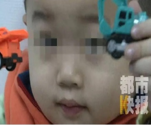 Bé trai 3 tuổi bị mù suốt 10 ngày chỉ vì bị cảm lạnh nhưng không điều trị dứt điểm