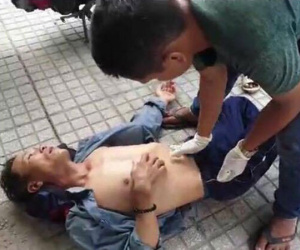 Bình Dương: Nam thợ hồ bị đôi nam nữ chặn đánh nhập viện để trả thù vụ va quẹt xe máy từ tháng trước