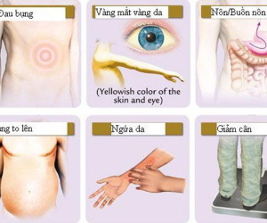 Ngứa liên tục có thể là dấu hiệu của căn bệnh ung thư có tỷ lệ mắc mới nhiều nhất tại Việt Nam
