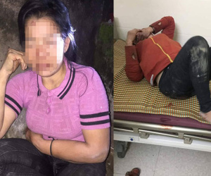 Một phụ nữ bị kẻ lạ đánh đập dã man vào vùng kín trong đêm