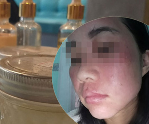 Nhiều người tố một spa Hà Nội bán mỹ phẩm kém chất lượng khiến chị em bị nổi mẩn ngứa, hỏng hết da mặt