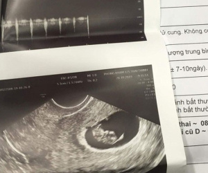 Vụ người vợ 28 tuổi hút mỡ bụng xong mới biết có thai: Bác sĩ thực hiện phẫu thuật sử dụng chứng chỉ giả