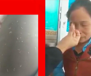 Video chữa bệnh kỳ quái,  'bắt sâu' trên mặt để chữa viêm xoang