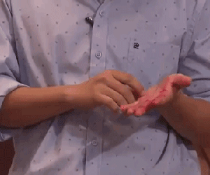 Trường Giang gặp sự cố bất ngờ, máu chảy đầm đìa trên sân khấu khiến khán giả xót thương
