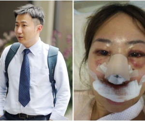 Bác sĩ hành hung dã man bạn gái khi bị từ chối quan hệ tình dục