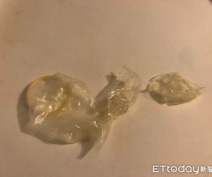 Đôi trẻ hoảng hốt cầu cứu bác sĩ vì vừa 'lâm trận' mà 'áo giáp' đã rách toang thành 3 mảnh